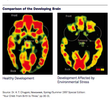 brain_comparison - Center for High Impact Philanthropy - University of ...