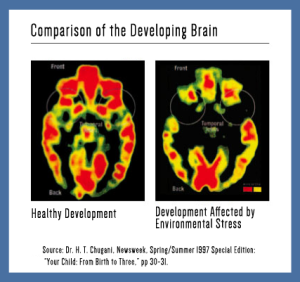 New Brain Research - Center For High Impact Philanthropy - University ...